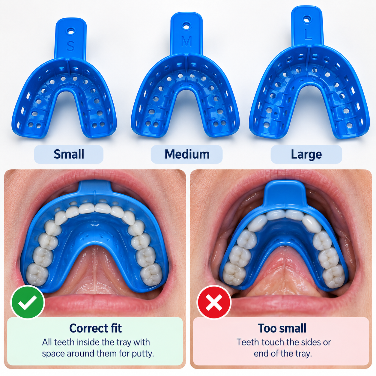 Choosing the correct size dental impression tray
