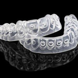 Upper and lower clear bleaching trays with gel placement dots
